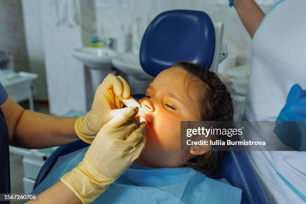 dentist touching cut frenulum of calm child after upper lip frenuloplasty surgery in orthodontic clinic. - suturing stock pictures, royalty-free photos & images