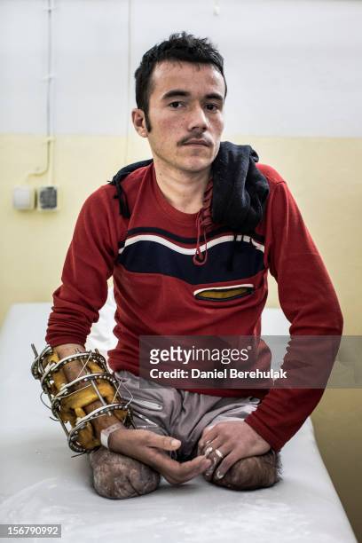 Commando, Khairuddin Sultan who joined the army 18 months ago, poses for a portrait after having a mould done for his prosthetic legs at the...