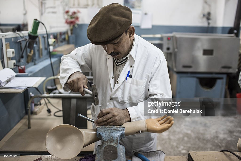 Afghan War Amputees And Civilians Treated At ICRC Orthopedic Center