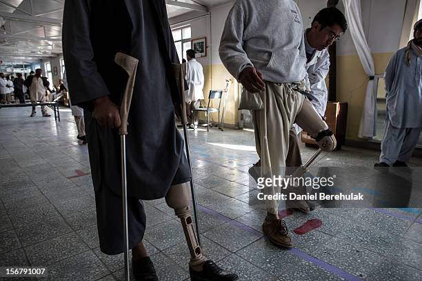 An orthopedic specialist checks the mobility of new prosthetic limb being fitted on to a patient at the International Committee of the Red Cross ,...