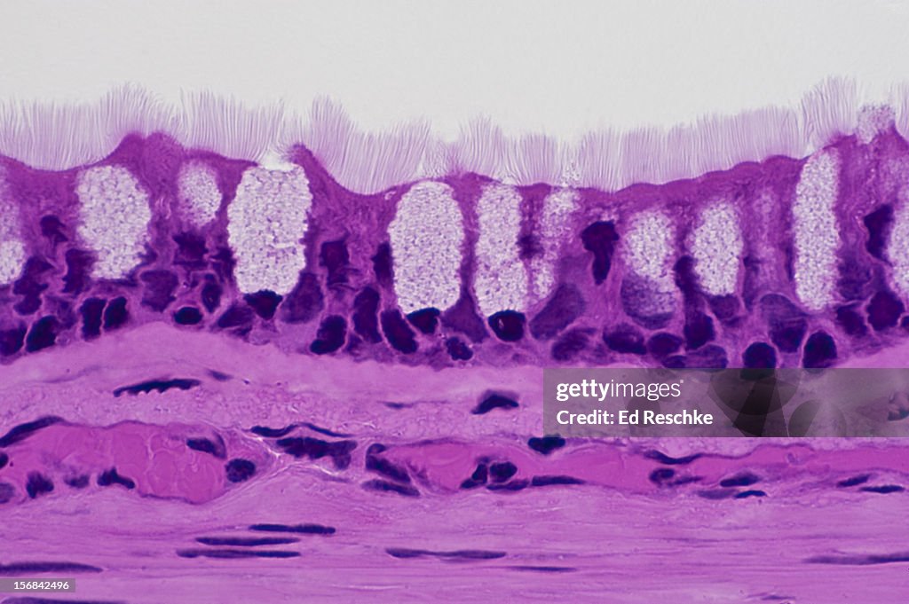 Pseudostratified Ciliated Columnar Epithelium