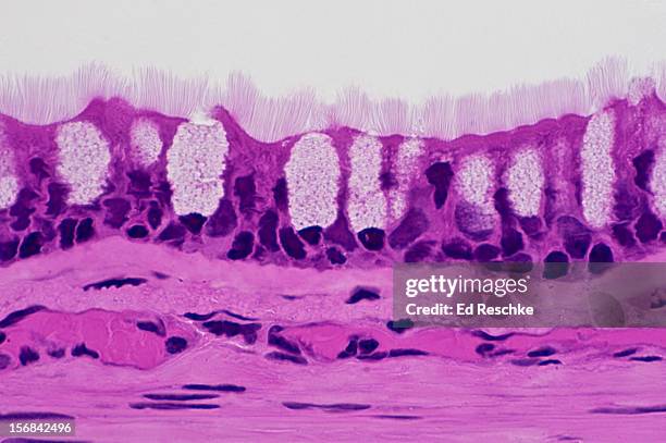 pseudostratified ciliated columnar epithelium - epitel bildbanksfoton och bilder