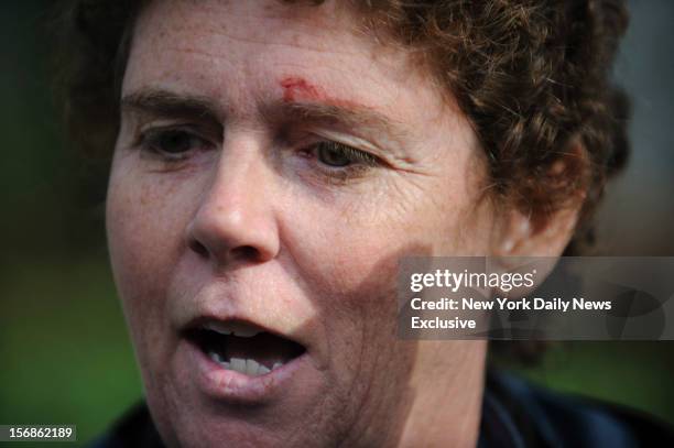 Associated Press photojournalist Nell Redmond was injured when Paula Broadwell swung her car door open on Monday, November 19, 2012 in Charlotte, N.C.