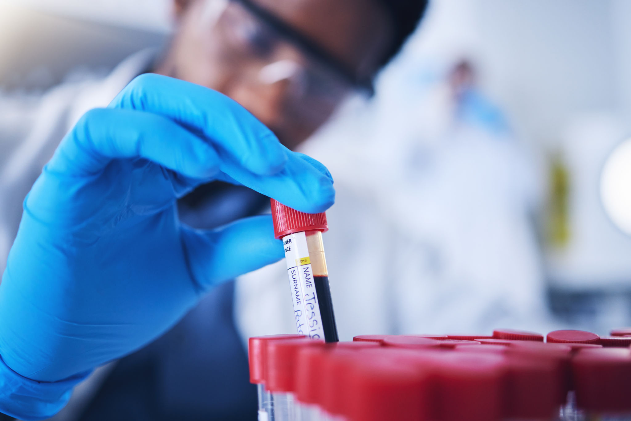 emergency blood work