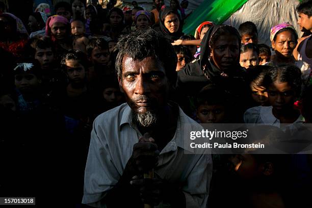 Ahmed is blind in one eye from lack of medical care surrounded by Rohingya families at a tented IDP camp November 24, 2012 on the outskirts of...