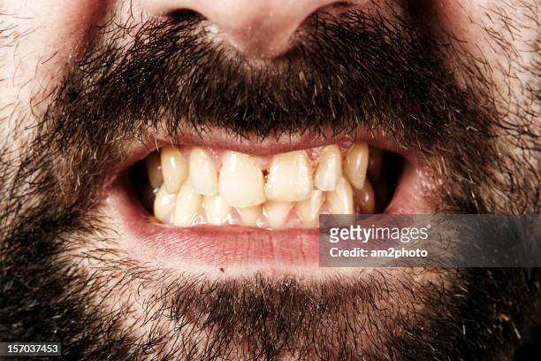 detalle de dientes sucias - cerrando os dentes - fotografias e filmes do acervo