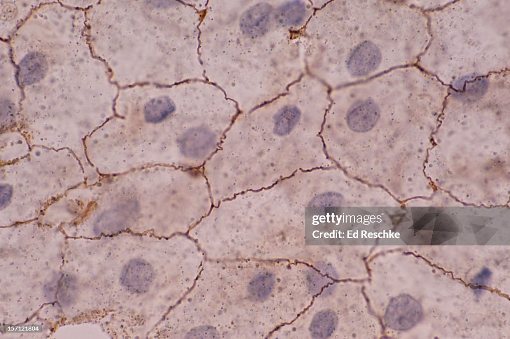 Simple Squamous Epithelium (Mesothelium), 250X