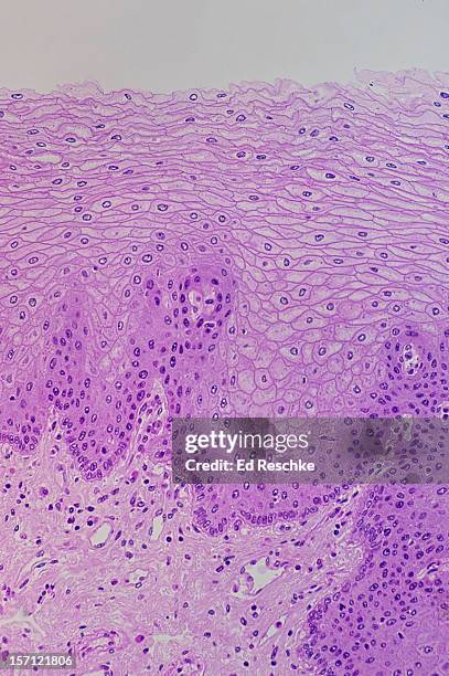 stratified squamous epithelium--nonkeratinized - plaveiselcelepitheel stockfoto's en -beelden