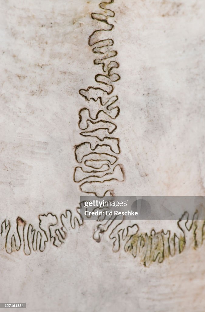 Sutures--fibrous immovable joints of the cranium