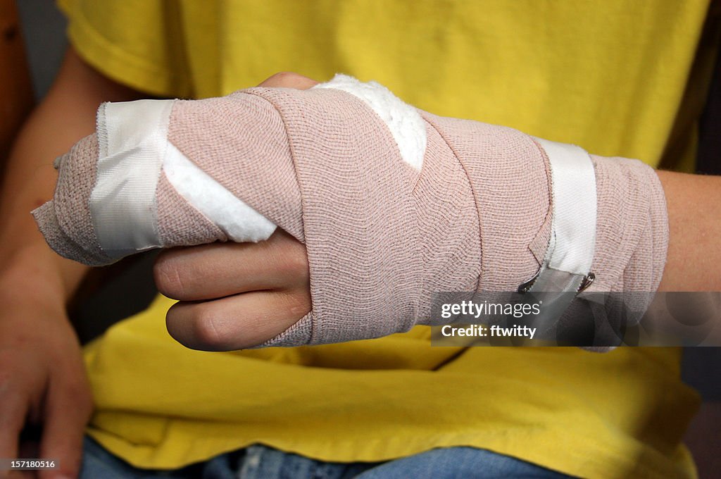 Injured person shows off wrist cast