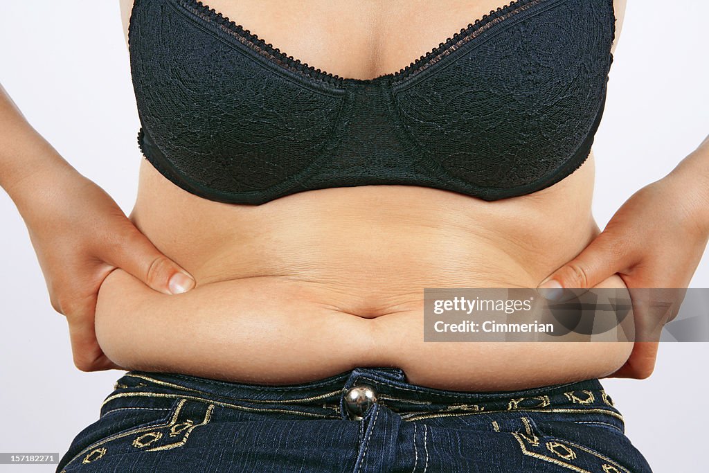 Obesity (overweight female belly)