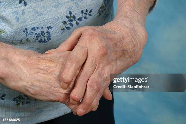 old person with skin spots on arthritic hands - rheumatism stock pictures, royalty-free photos & images