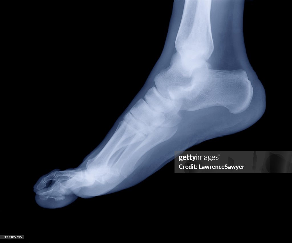 Pie de rayos x