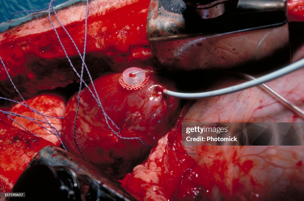 Scientific measurements on a sheep's heart