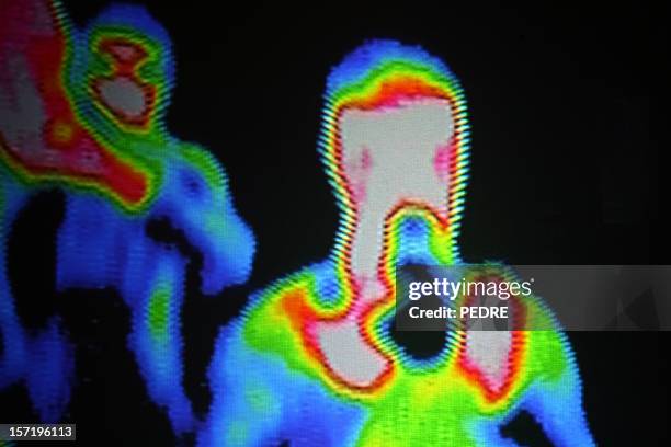 thermographic areas of a photographer - thermal imaging stock pictures, royalty-free photos & images