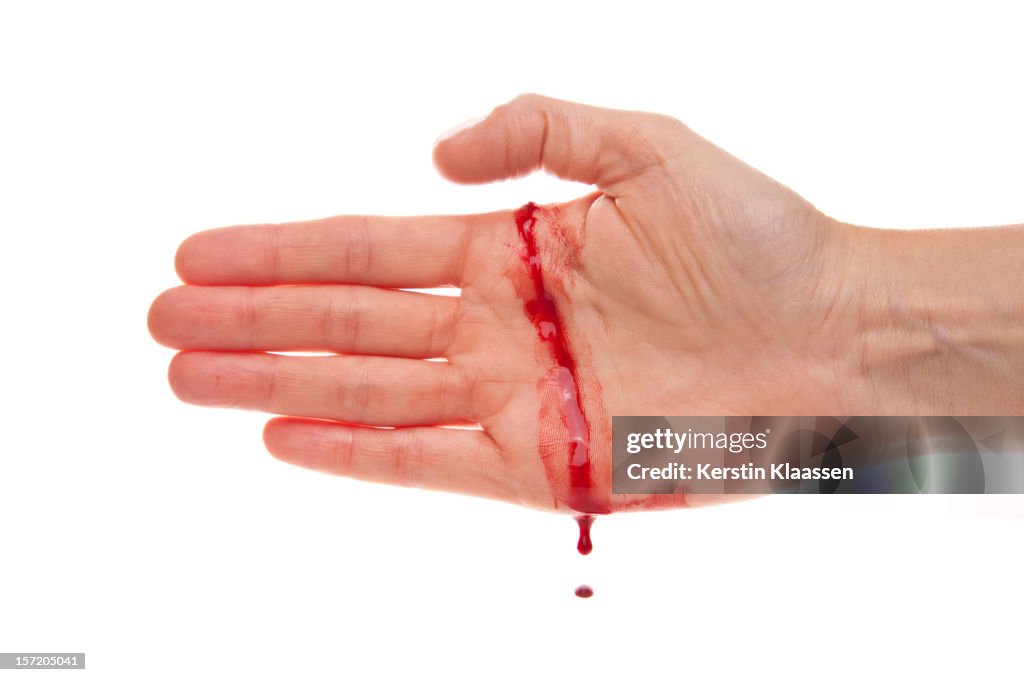 Bleeding hand with a real cut