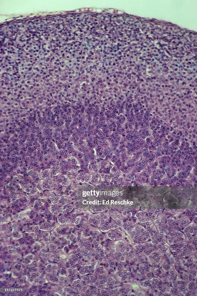 Adrenal Cortex--all three histological zones