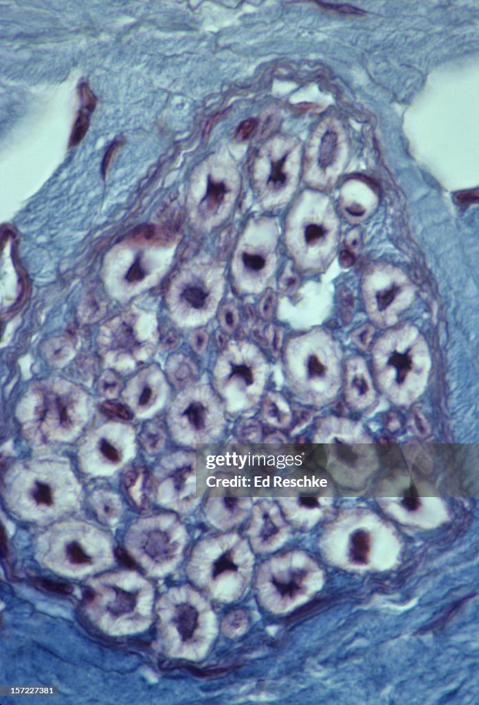 Myelinated Nerve Fibers--nerve in cross section
