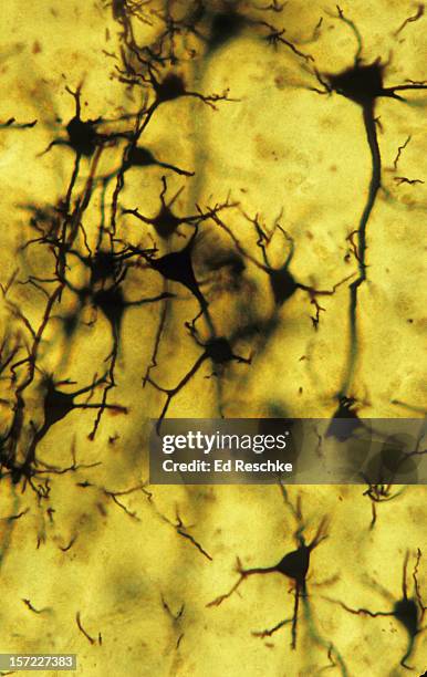 neurons (pyramidal cells), cerebral cortex, 100x - cerebral cortex stock-fotos und bilder