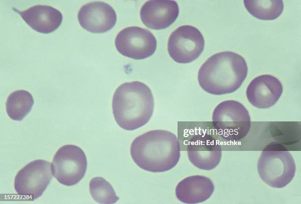 pernicious anemia, human blood smear, 500x - eisenmangel stock-fotos und bilder