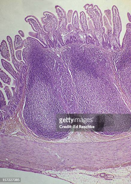peyer's patch--aggregated lymphatic nodules, ileum - ghiandola intestinale foto e immagini stock