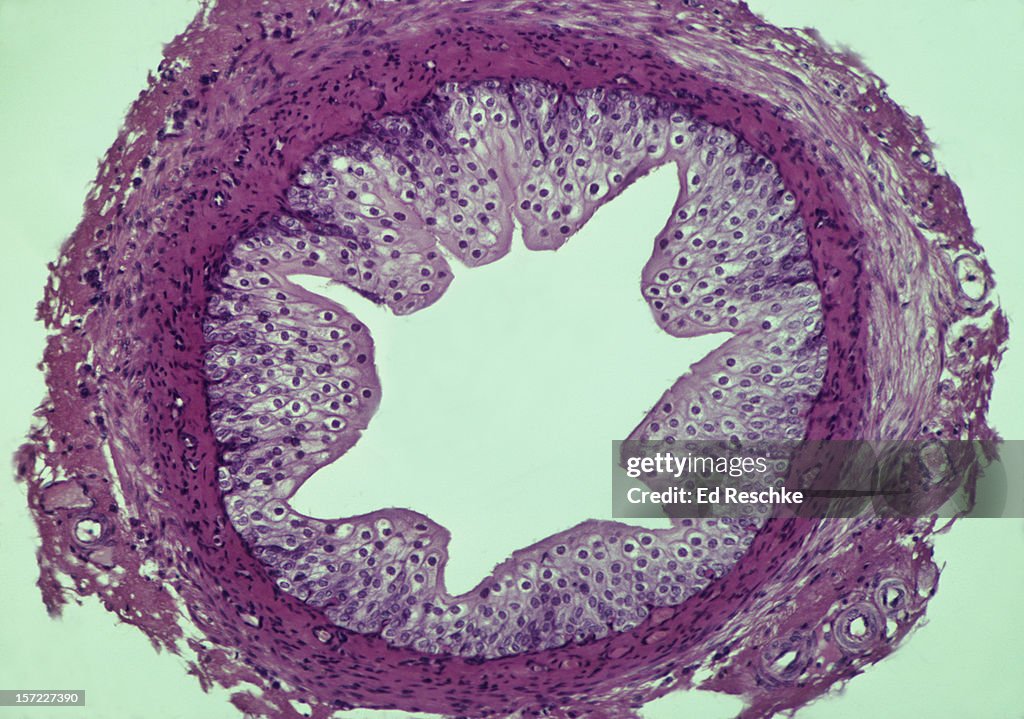 Ureter--Mucosa, Muscularis, and Adventitia, 25X