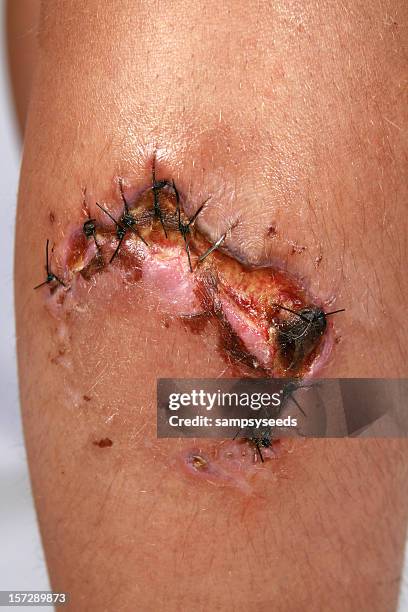 nasty cachorro refeição - dog bite wound - fotografias e filmes do acervo