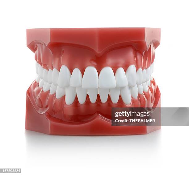 mi mejor sonrisa - molde dental fotografías e imágenes de stock