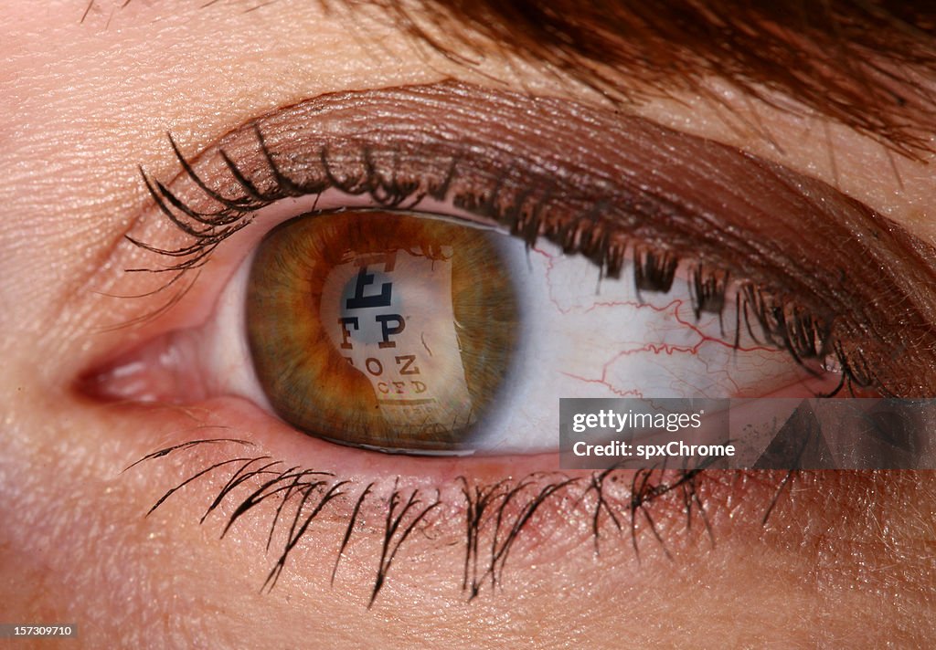 Eye Exam - Chart Reflection