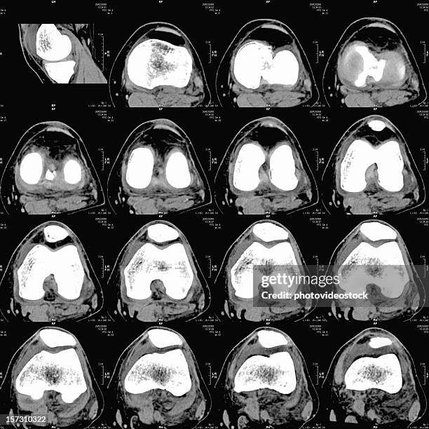 knee cat - tomography stock pictures, royalty-free photos & images