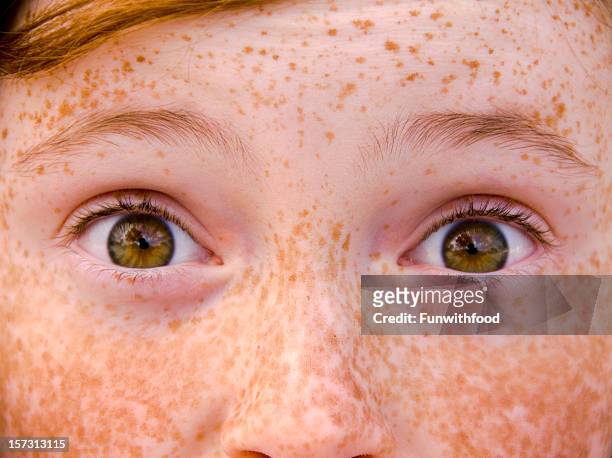 child & eyes wide open, irish redhead freckle face surprised girl - eye open stockfoto's en -beelden