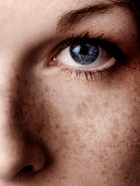 Close-Up of Woman's Blue Eye and Her Freckles Across Cheek