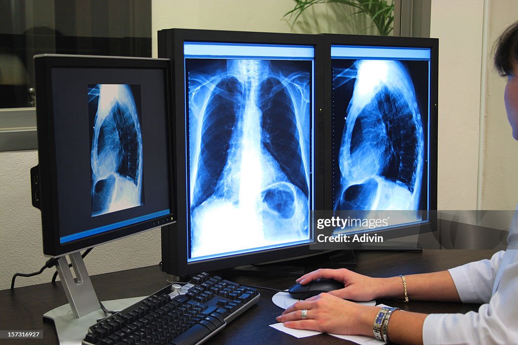 Analyzing x-ray or scann radiography