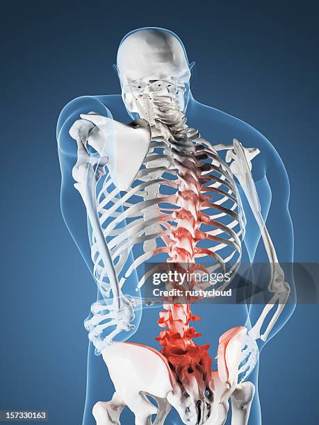 Back Problems Skeleton 2,218 Skeleton Back Pain Stock Photos, High-Res Pictures, and Images ...