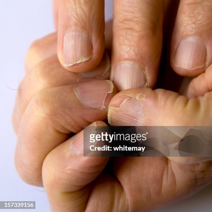 574 Broken Nail Photos and Premium High Res Pictures - Getty Images
