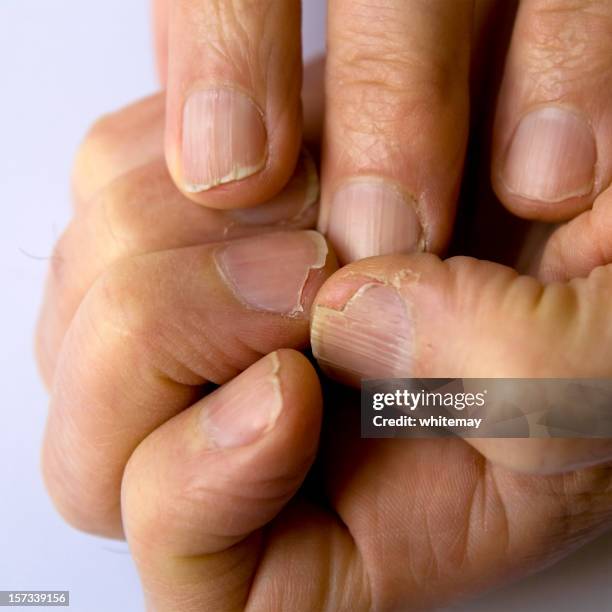 fingernail disaster zone - grooved stock pictures, royalty-free photos & images