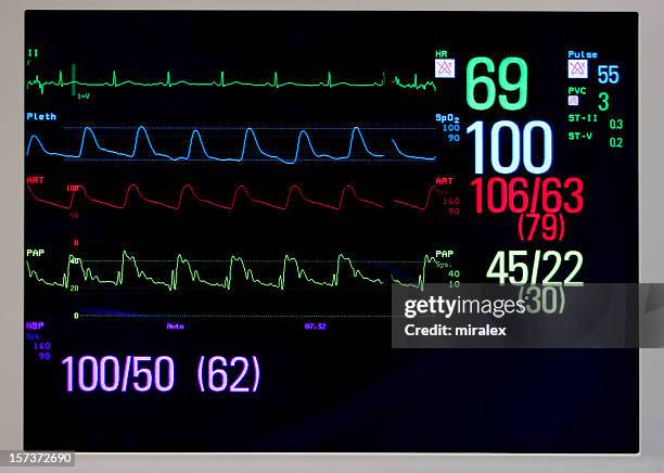 cardiac monitor displays ekg, pulse, and blood pressure - bewakingsapparatuur stockfoto's en -beelden