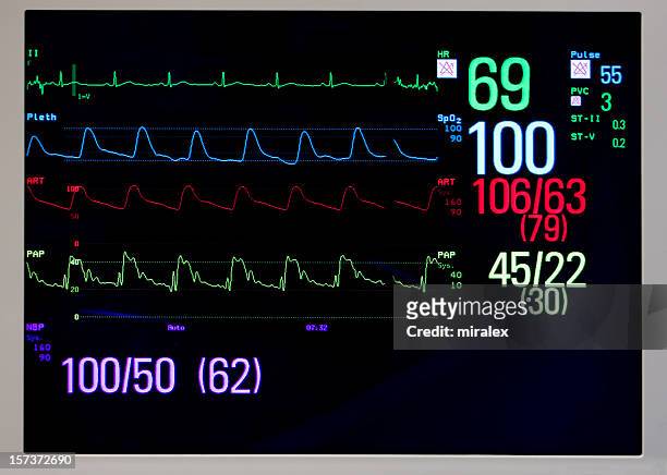 cardiac monitor displays ekg, pulse, and blood pressure - monitoring equipment stock pictures, royalty-free photos & images