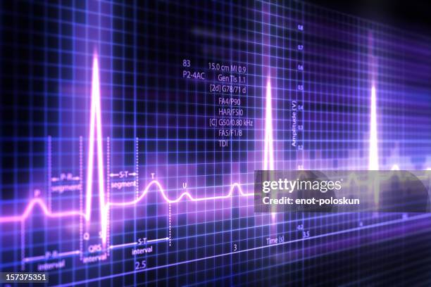 el ecg - electro fotografías e imágenes de stock