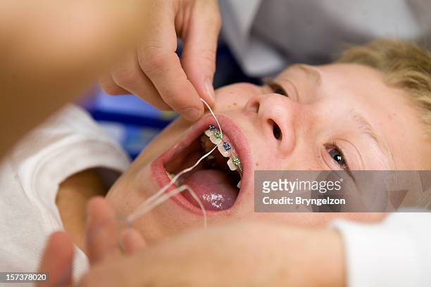 flossing with braces - braces stock pictures, royalty-free photos & images