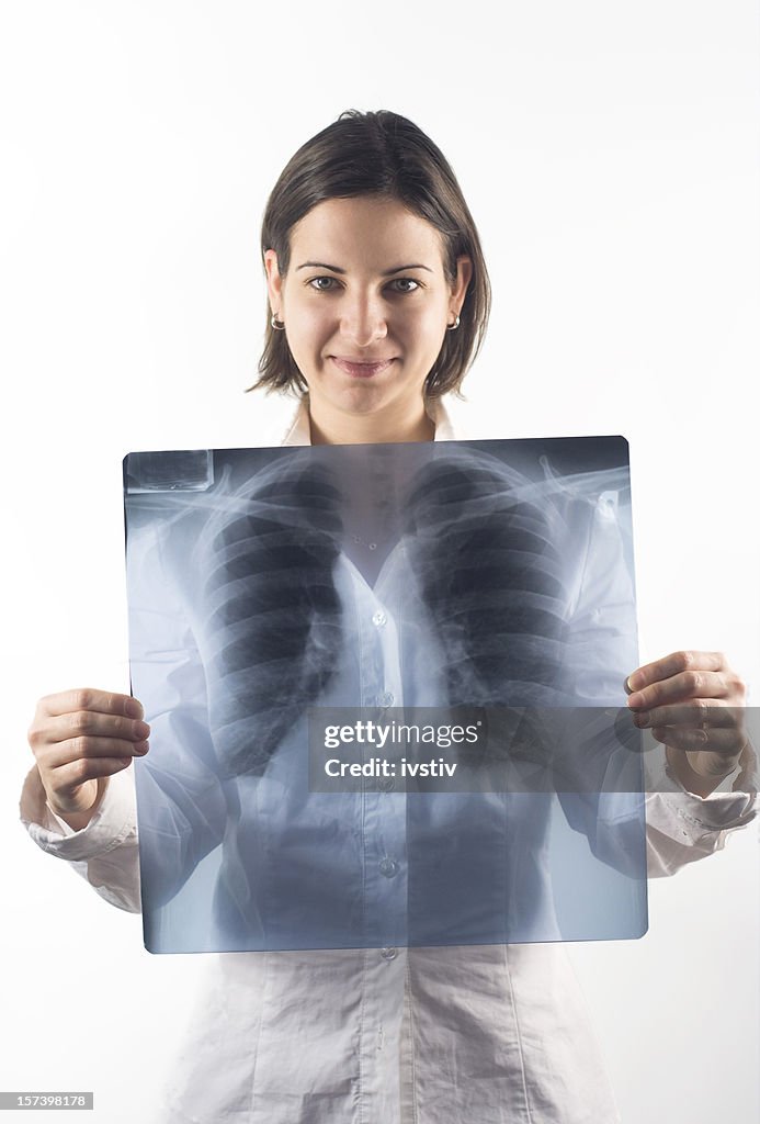 Woman holds X-ray lung