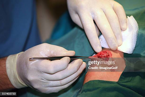 inspektion eine wunde - wunde stock-fotos und bilder