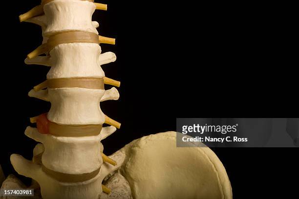 spina dorsale umana, pelvi, chiropratico, ortopedico, modello medico, sanità, isolato - colonna vertebrale foto e immagini stock