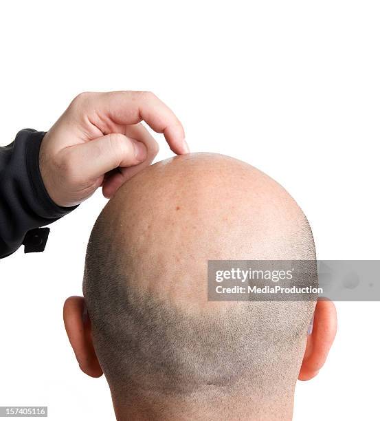 scratch - balding stock pictures, royalty-free photos & images
