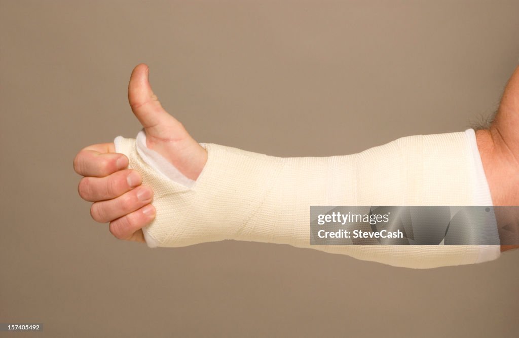 Mans arm in cast