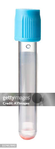 test tube for blood sample - test tube stock pictures, royalty-free photos & images