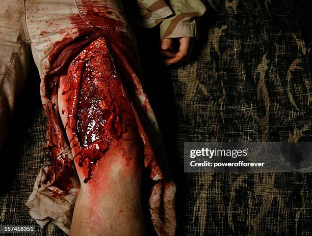 filleted skin - bloody leg stock pictures, royalty-free photos & images