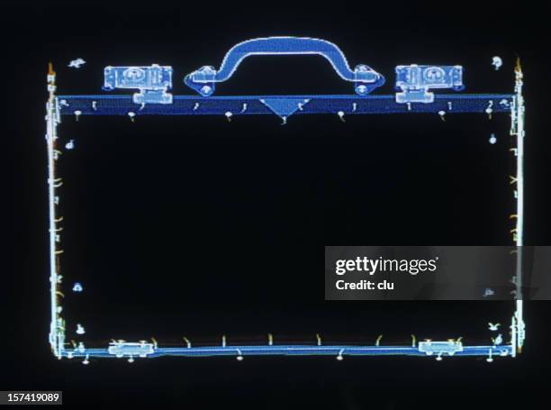 X Ray Frame 86 Xray Frame Stock Photos, High-Res Pictures, and Images - Getty Images