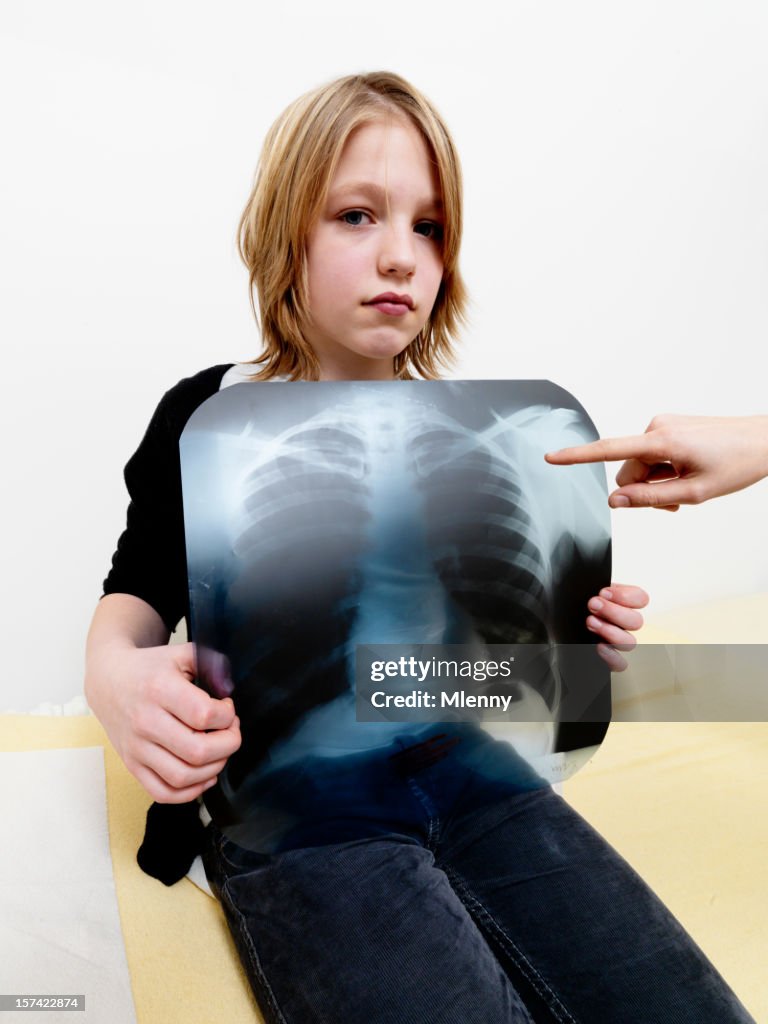 Young Girl holding imagen de rayos X