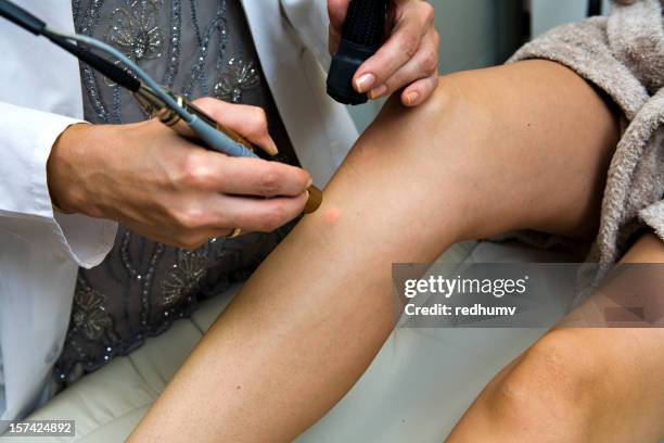 dermatologist performs laser hair removal - electrolysis stock pictures, royalty-free photos & images